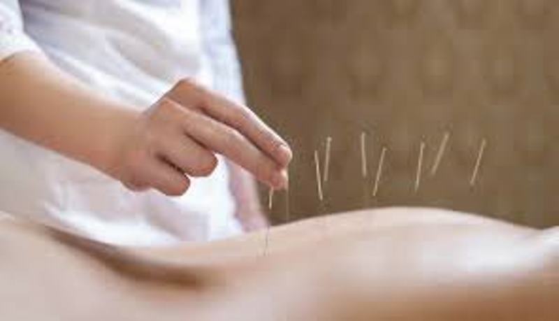 Akupunktur tedavisine gelen hastaların