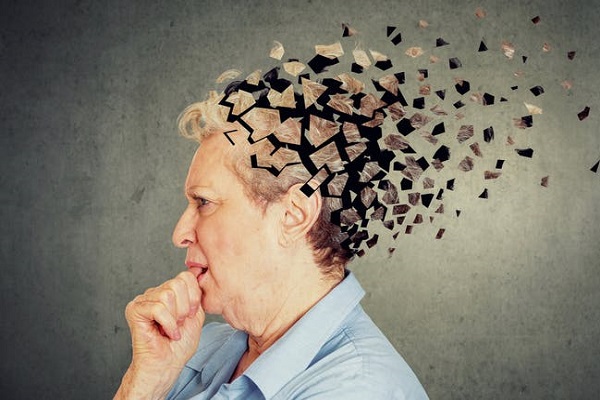 Alzheimer hastalığı, hafıza ve