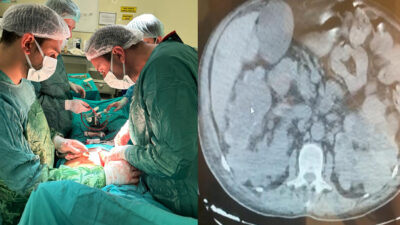 Siirt Eğitim ve Araştırma Hastanesi'nde, 66 yaşındaki N.Y. adlı hastaya