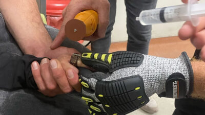 Siirt’te araba tekerleğinin cıvatasını parmağına geçiren genç hastanelik oldu. Gencin