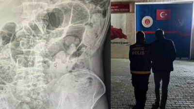 Siirt Emniyet Müdürlüğünün başarılı operasyonunda uyuşturucu madde yutan İran uyruklu