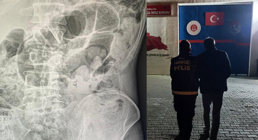 Siirt Emniyet Müdürlüğünün başarılı operasyonunda uyuşturucu madde yutan İran uyruklu