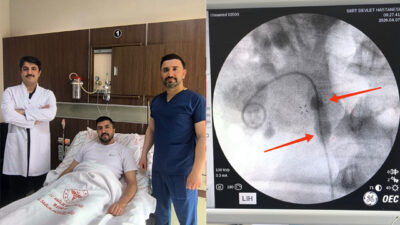 Siirt Eğitim ve Araştırma Hastanesi'nde gerçekleştirilen başarılı bir operasyonla, daha